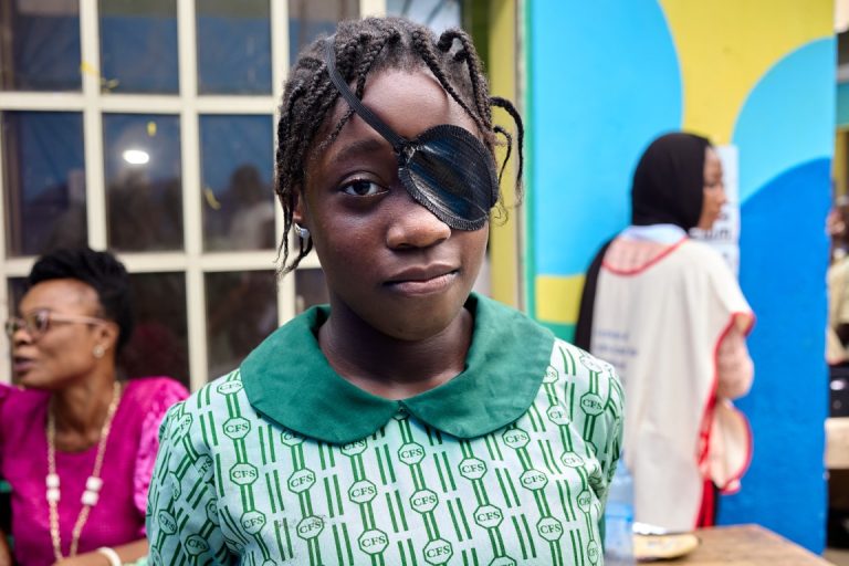 Using an Eye Patch During Screening