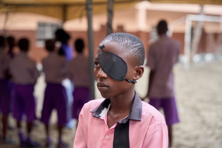 Eye Patch Applied For Vision Screening